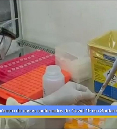 Sobe para 13 o número de casos confirmados de Covid-19 em Santarém
