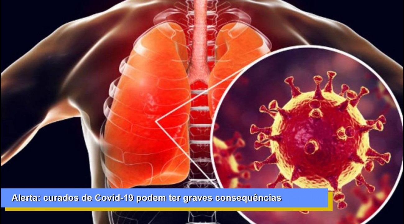 Alerta: curados de Covid-19 podem ter graves consequências
