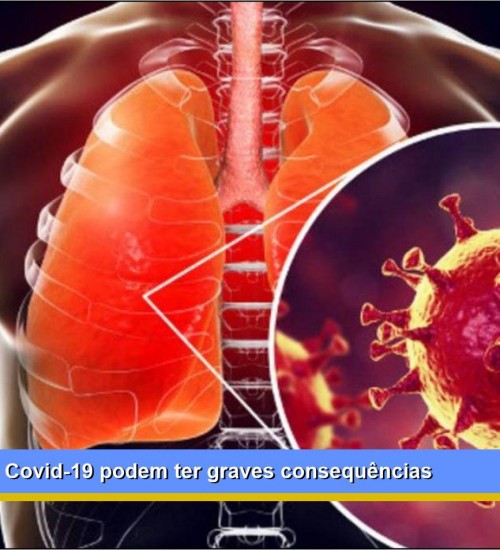 Alerta: curados de Covid-19 podem ter graves consequências